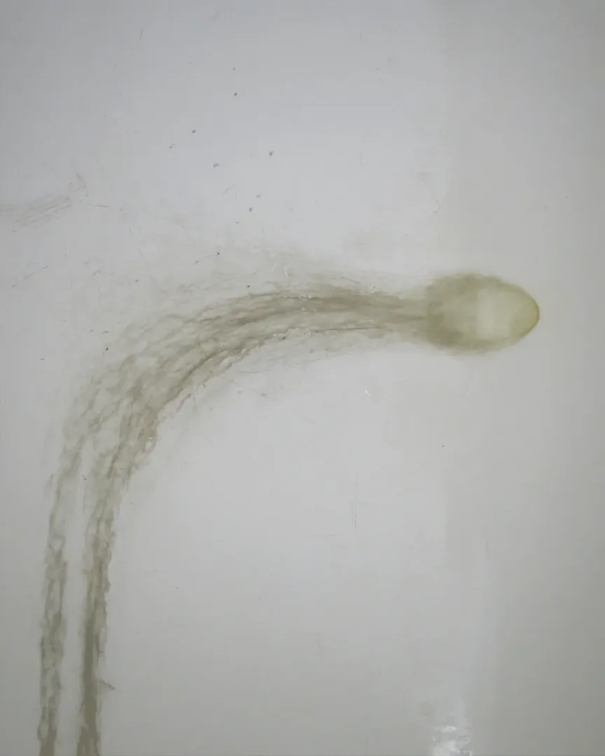 Miniature 3 de SEMINALIS